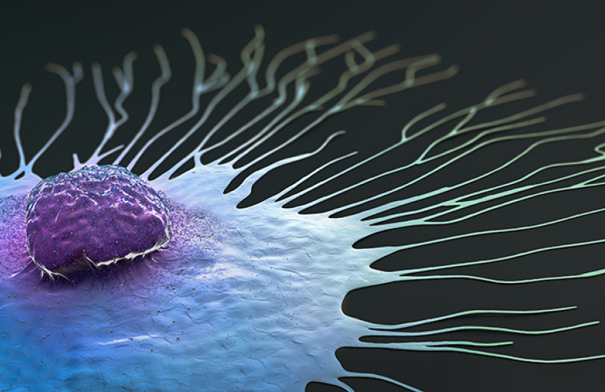 Digital illustration of a single breast cancer cell spreading
