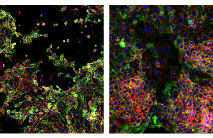 cancer cells