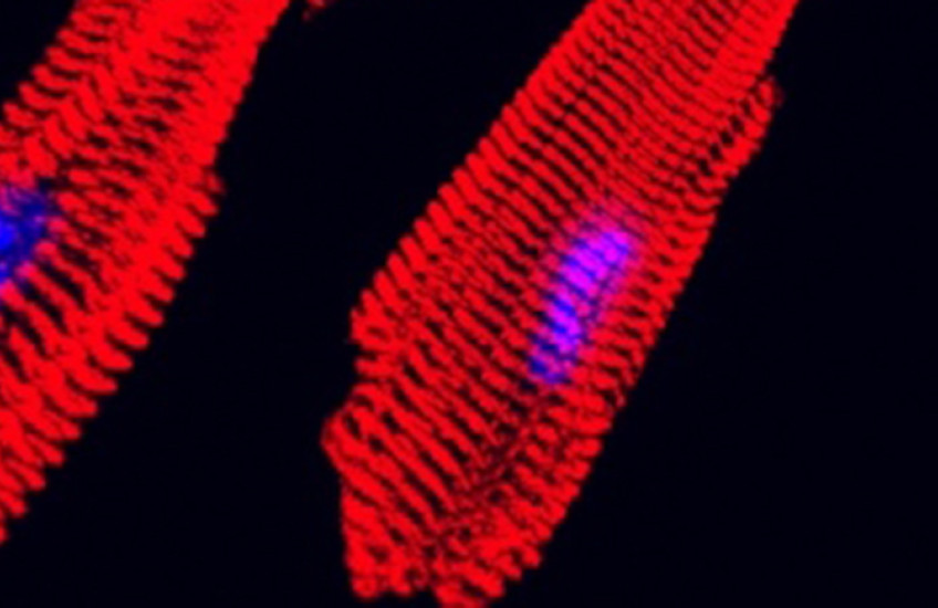 Microscopy image of red striated heart muscle fibers with blue nuclei