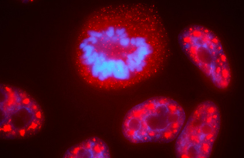 microscopy image of a cell nucleus showing distinct compartments