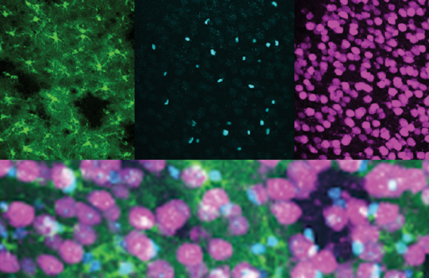 four microscopy images in green, purple and blue