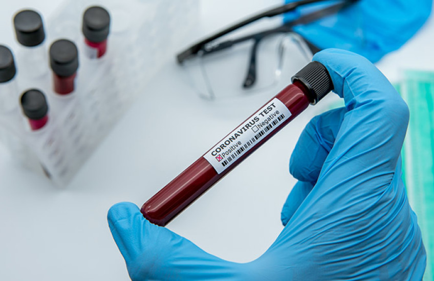 a gloved hand holds a test tube