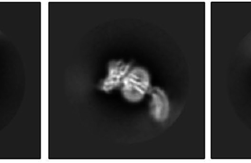 Three black-and-white microscope images of a protein with three segments, the third one curved like a tail