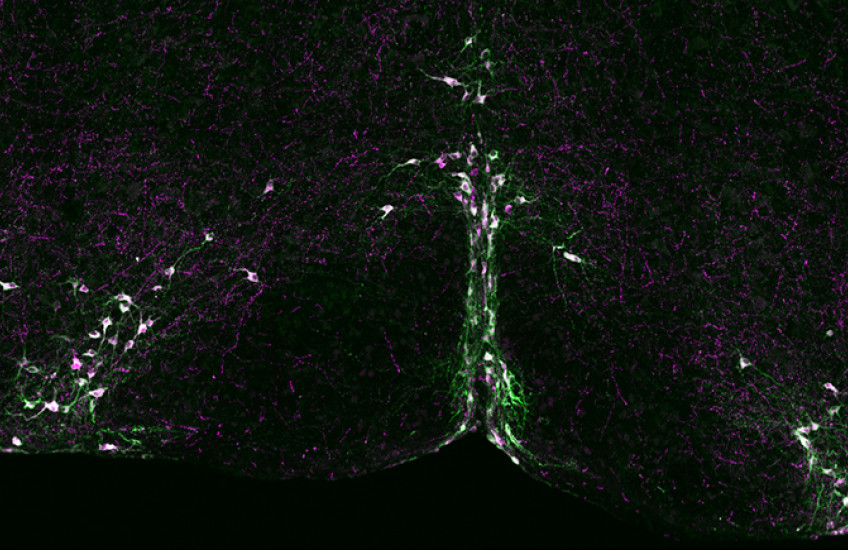 Arc of neurons in purple and green