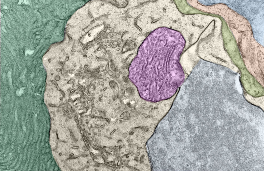 Colorized micrograph shows a magenta blob amid gray and beige blobs, with a green background