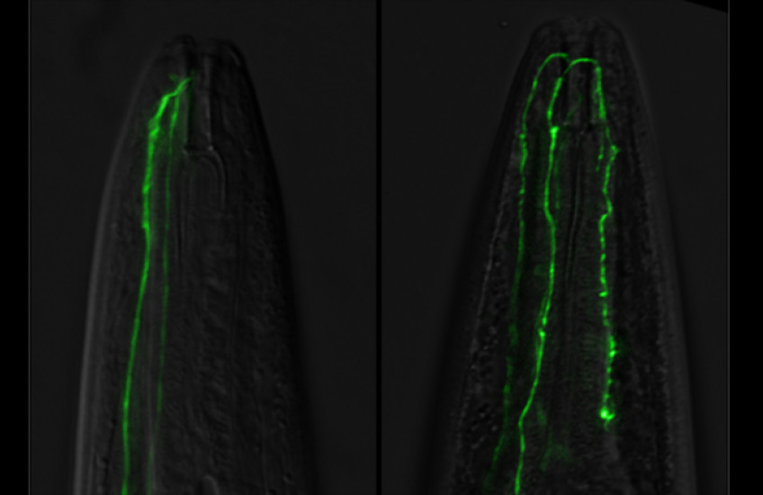 fluorescent neuron is longer than normal