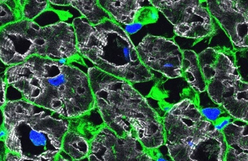 Microscopy shows cells in green and nuclei in blue