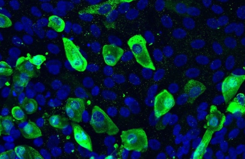 Magnified cells glow green and blue against a black background