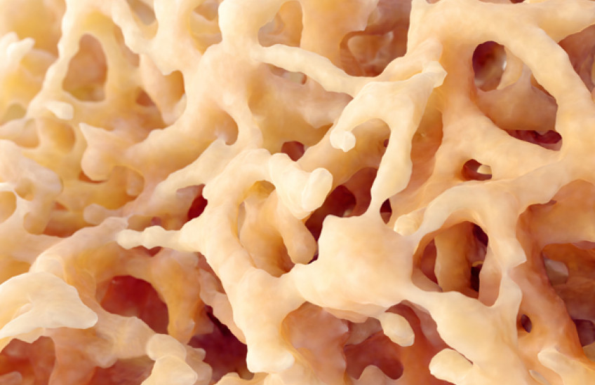 Bone structure