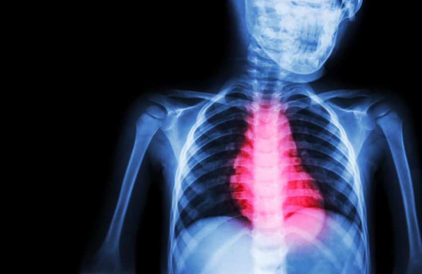 Illustration of reddened heart against blue skeleton X-ray