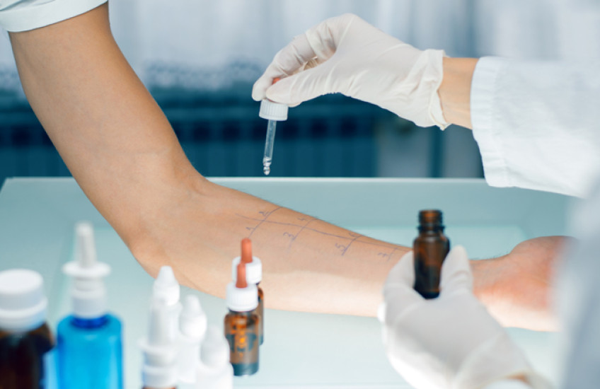 Allergy test being administered on a patient's armi