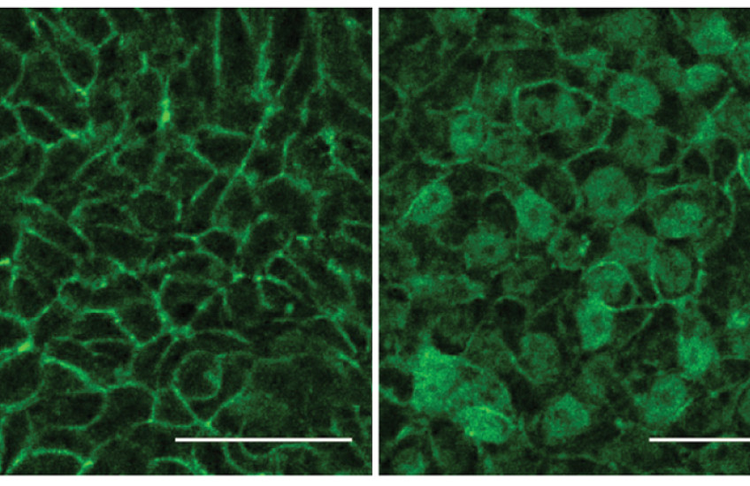 Two micrographs side by side wih green-stained cells arranged in different patterns