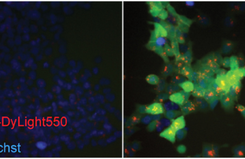On the right, increased LDL uptake (in red) and GFP in cells after Cas9 repair of a mutation in the LDLR gene found to cause abnormally high cholesterol. 