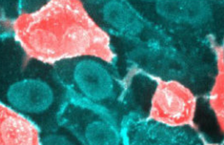 Microscope image of cells with SARS-CoV-2 penetration, indicated by pink stain on teal cells