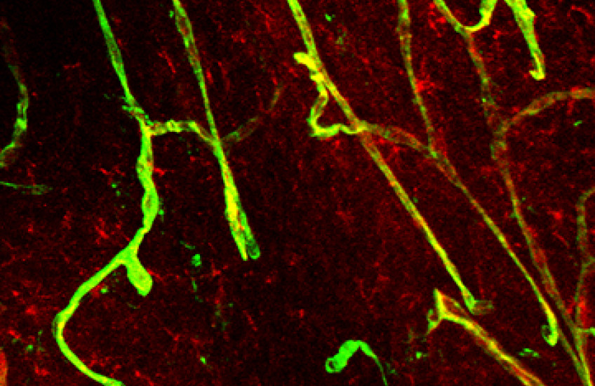 Image of blood brain barrier 