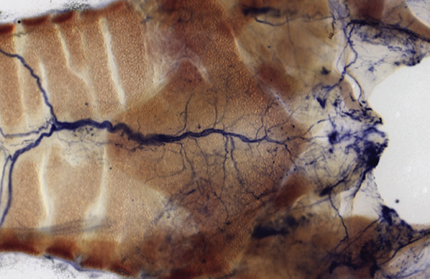airway neurons