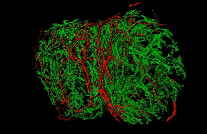 Rotating micrograph of nerve fibers and lymph nodes in red and green shaped like a two-lobed bean