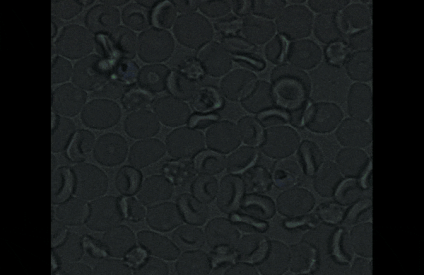 parasites suck it up