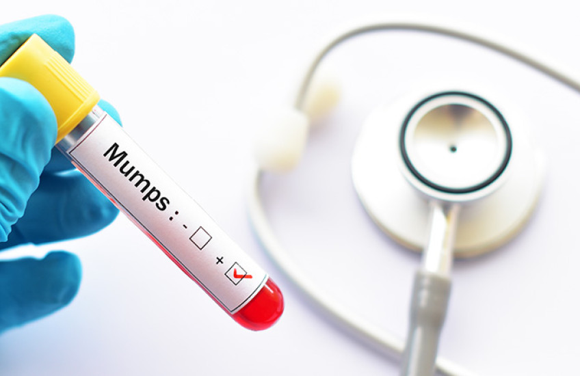 photo of gloved hand holding vile marked mumps