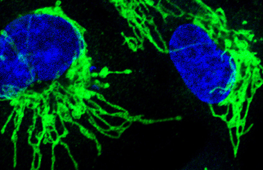 Microscopy image of two cell nuclei in blue and spindly misshapen mitochondria in green against a black background