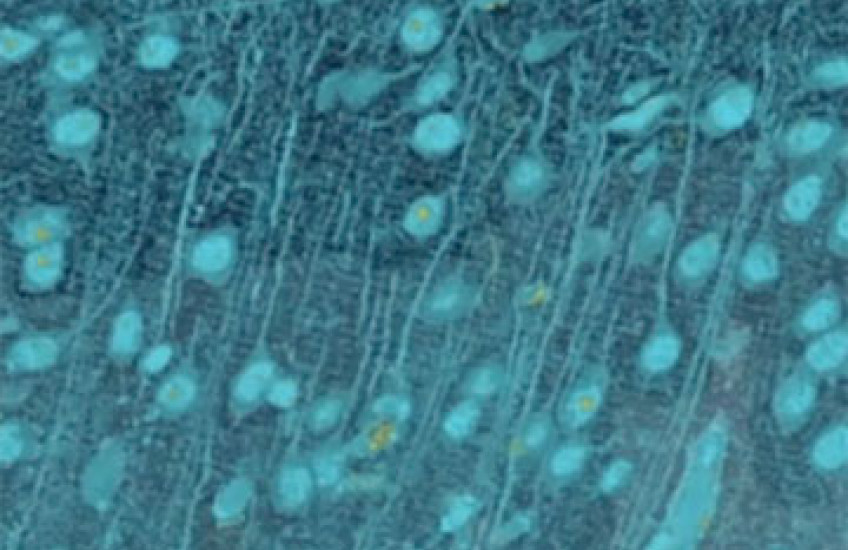 Web-Crawling the Brain