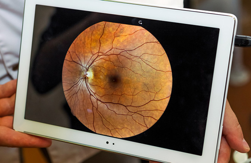 image of ocular funds being presented on an iPad 