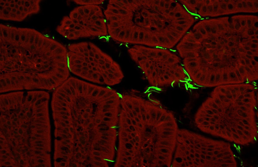 Microbes