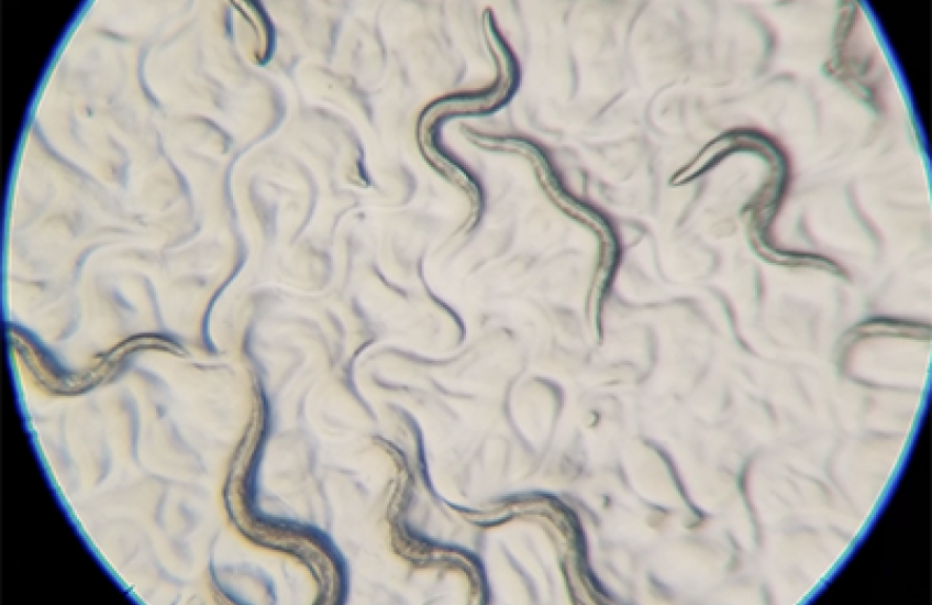 worms squiggle across a microscope slide