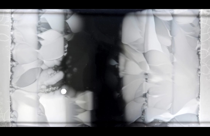 Microscopic look at bacteria