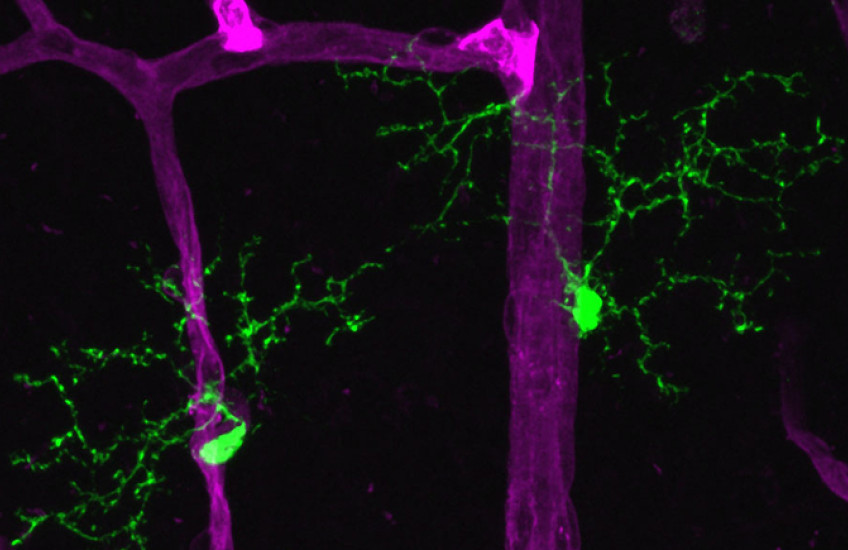 retinal microglia and retinal vasculature