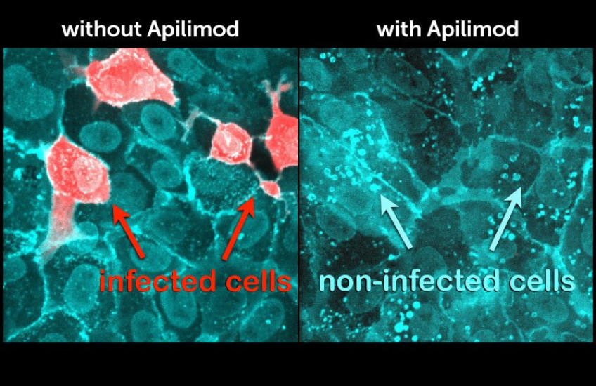 Side by side microscope comparisons of cells with and without SARS-CoV-2 penetration, indicated by pink stain on teal cells