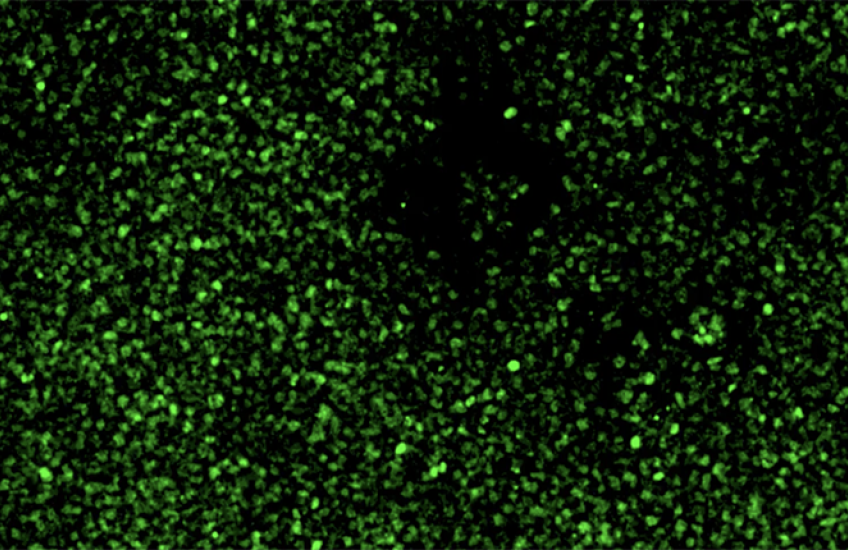 Field of hundreds or thousands of cells glow green against a black background 