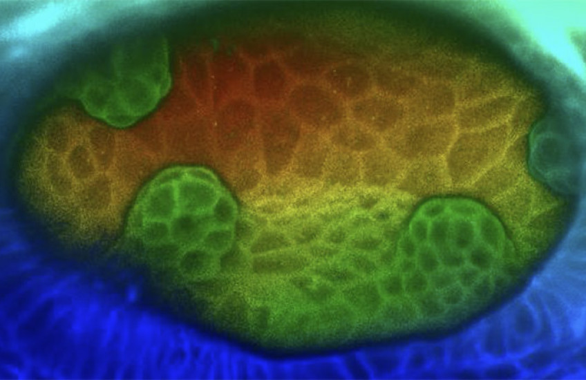 A time lapse microscope image of cells forming the semicircular canals