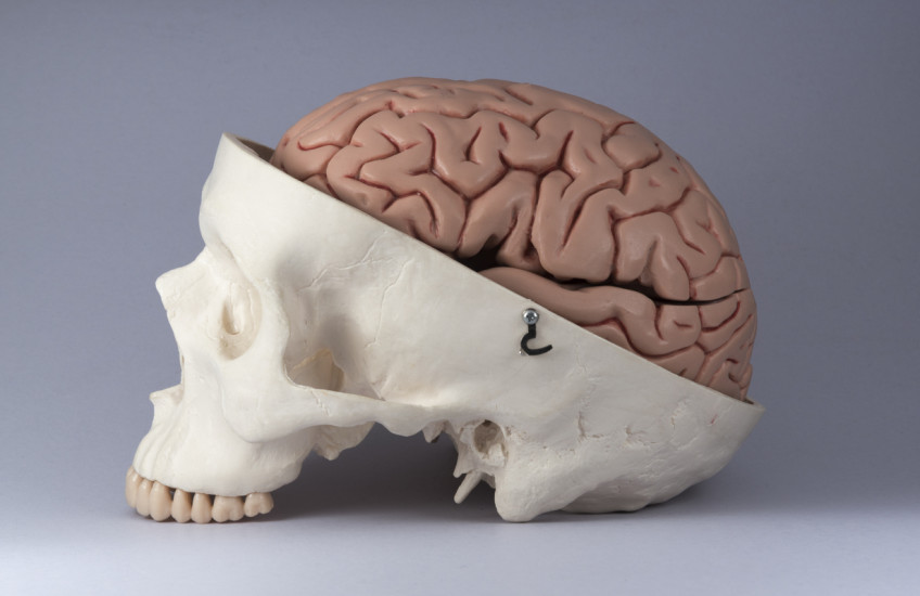 Skull and brain
