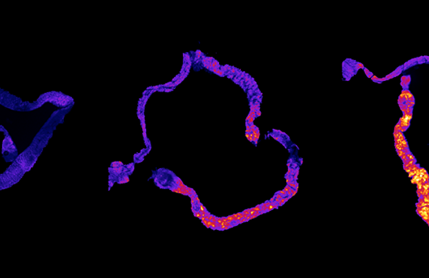 ros accumulation