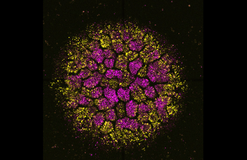 Microscope image shows a round conglomeration of cells dyed purple and yellow