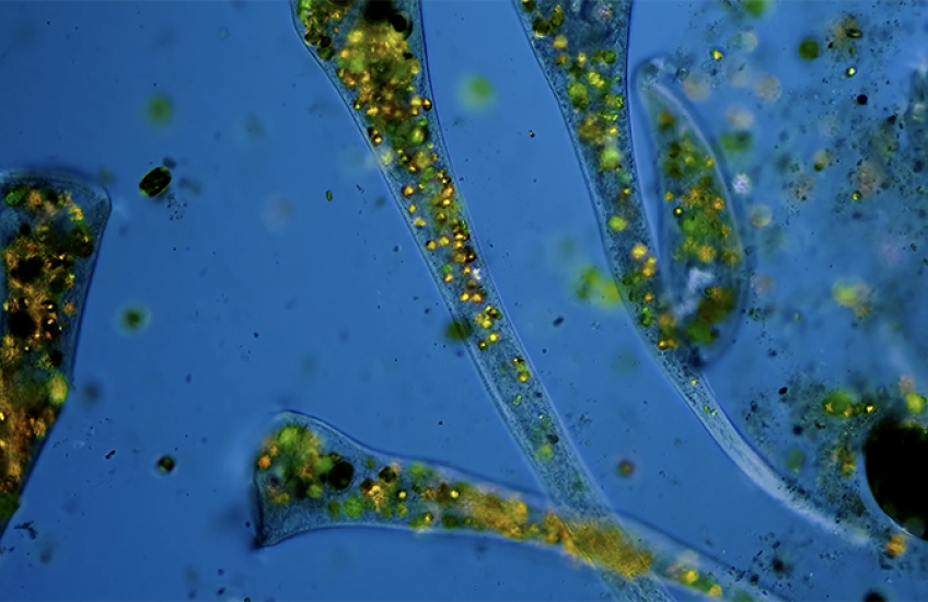 a micrograph of trumpet-shaped Stentor roeselii