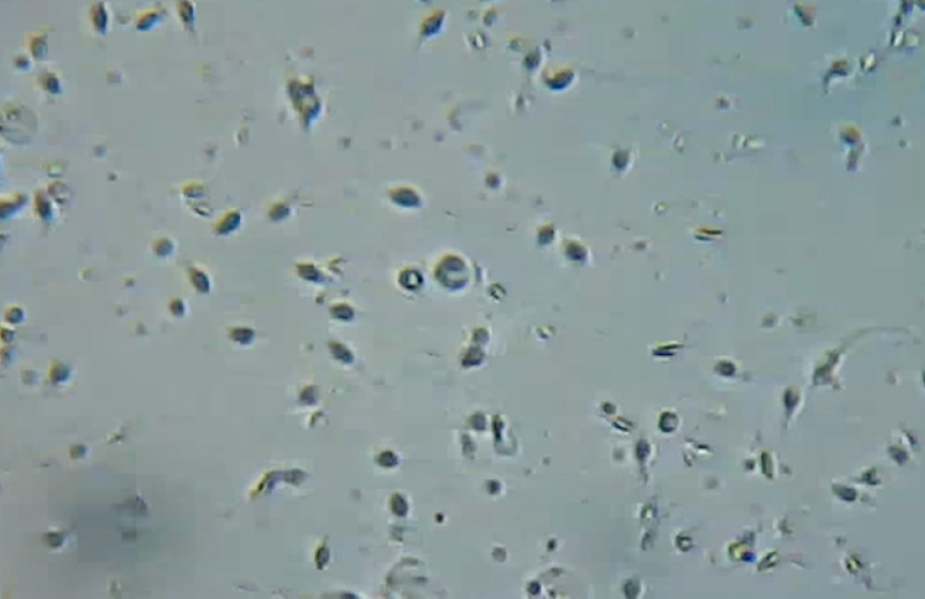 Grayscale image of sperm cells under a microscope