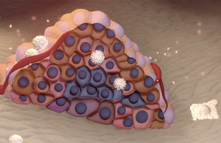 illustration of a small tumor