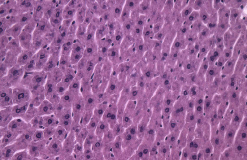 Histology slides show lipid molecules in mouse livers