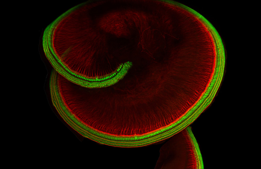 The snail-shell-shaped part of the inner ear that houses hair cells.