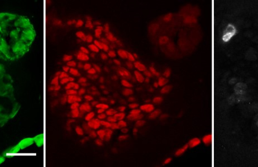Three squares side by side with a large and a small cell under microscopy: one in green, one in red and one in white