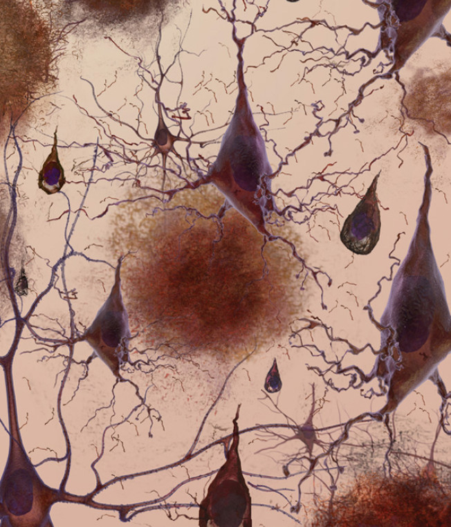 Brain Drain