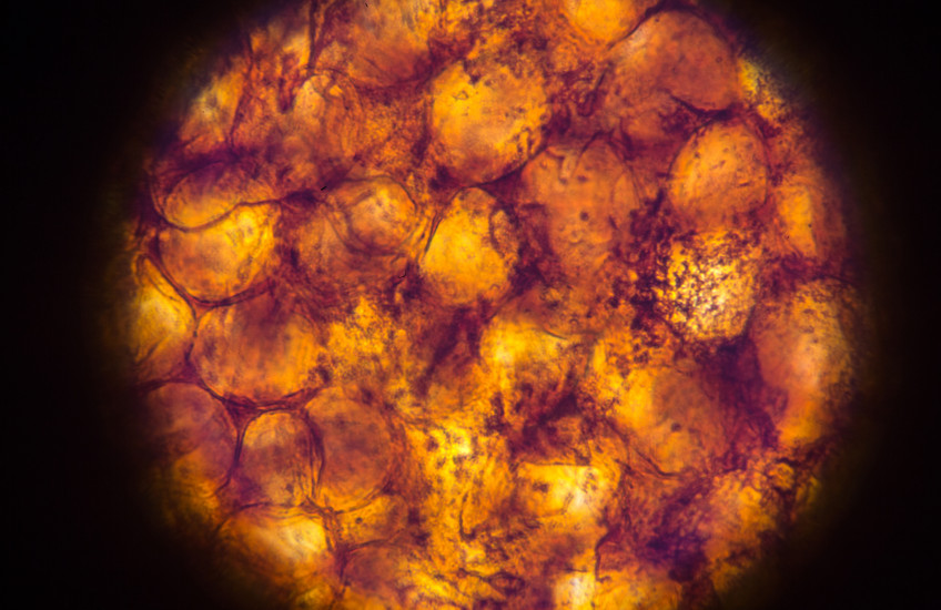 Does the Emperor Have Clothes?