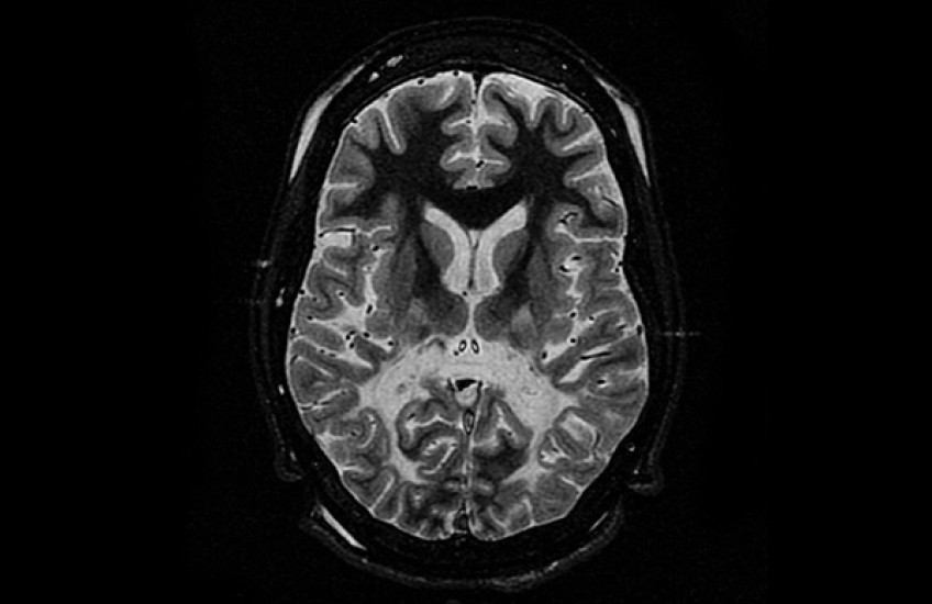 Stopping Things CALD