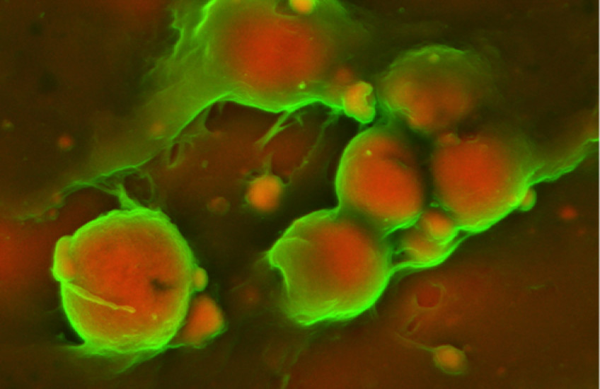 Inside Insights on Cardiovascular Buildup