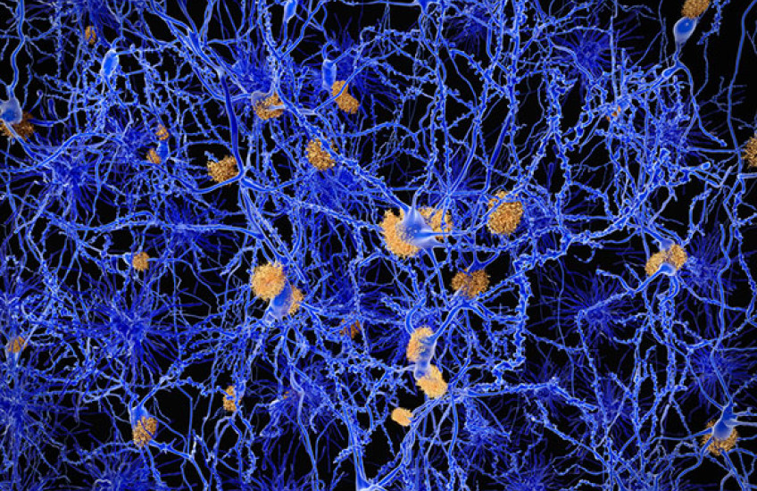 Propelling Alzheimer’s Research