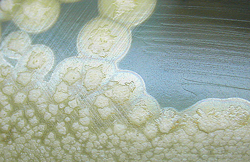 Uncovering Toxin X