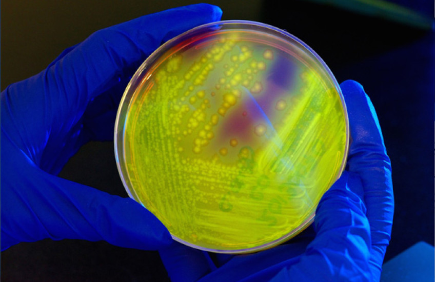 Protection from C. diff?  