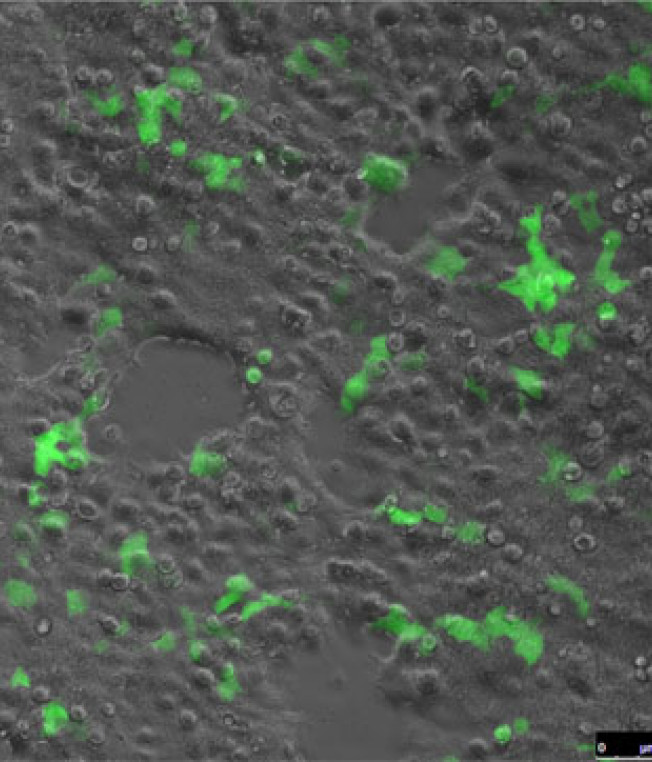 A Sharper Tool for Genome Engineering
